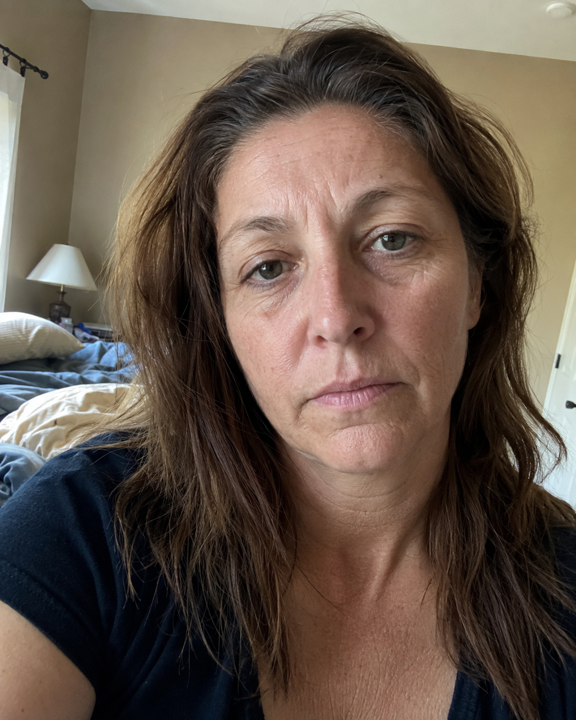 Before — using NAD+ EGF Firming Serum
