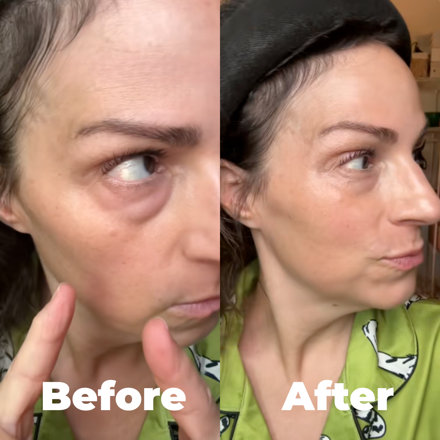 Arelia Collagen Patches