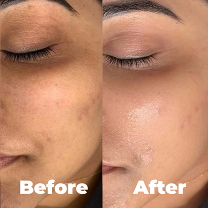 Arelia Collagen Patches